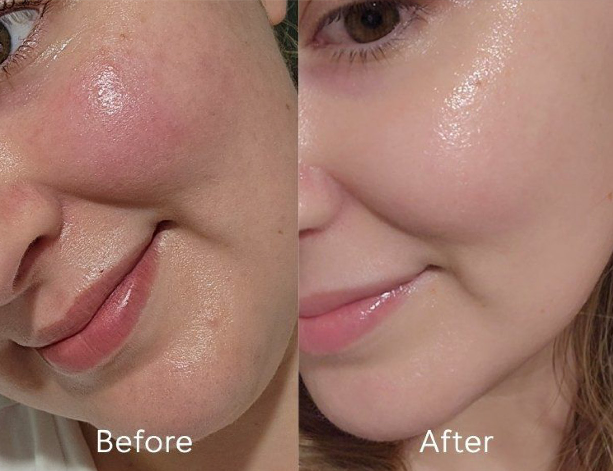 Skin Cleansing Cream Skin Cleansing Cream