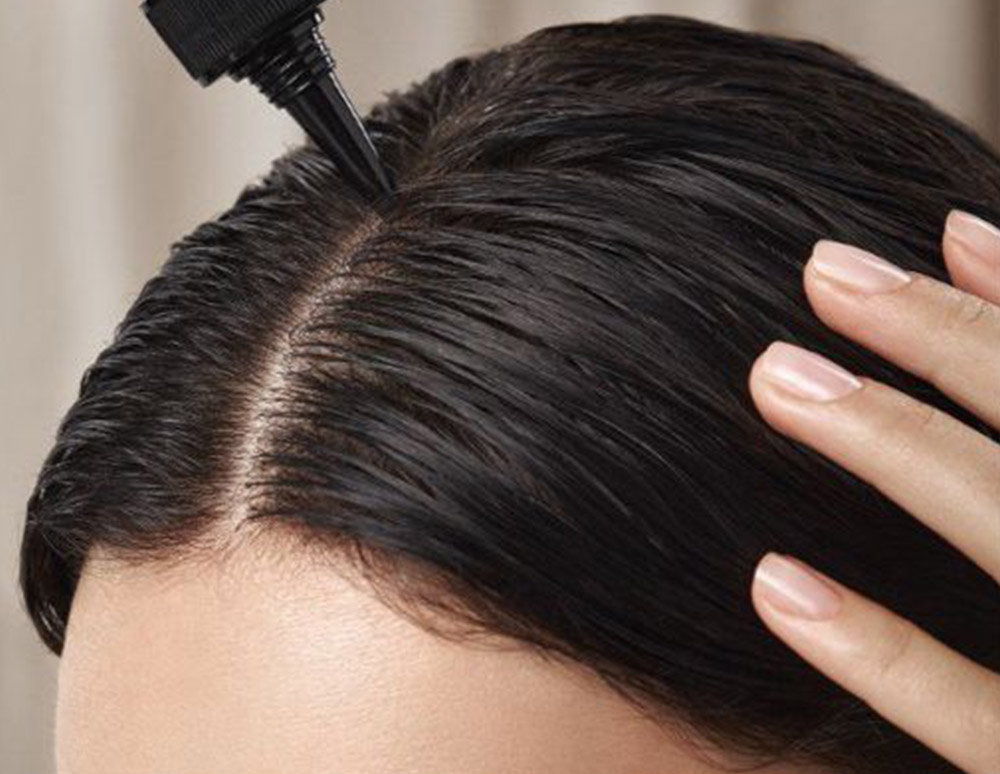 Hair loss prevention  shampoo