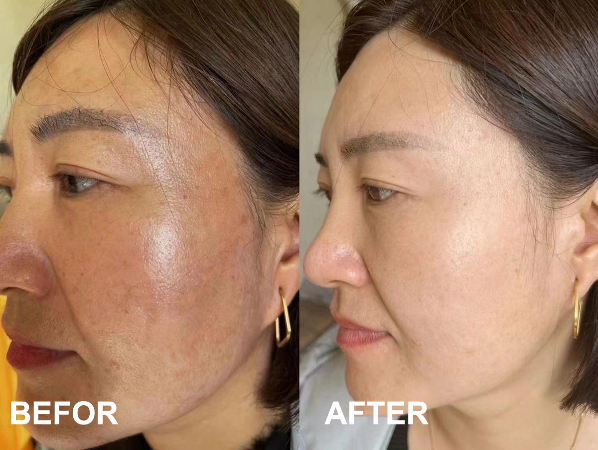 8% Tranexamic Acid Serum Toner