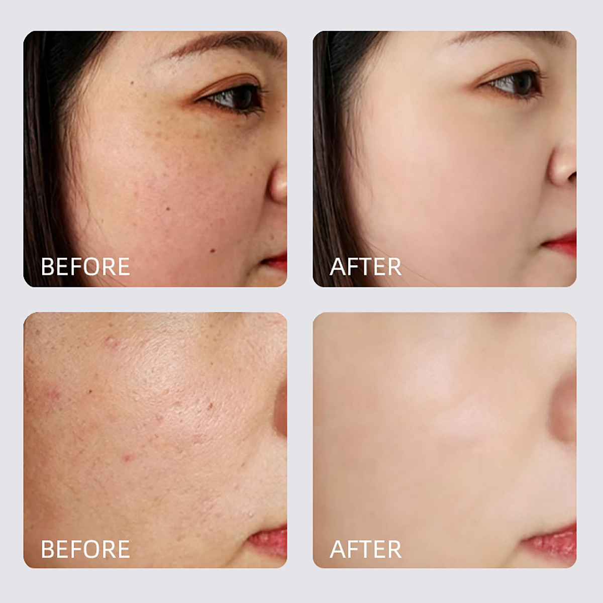 Brightening & Dark Spot Correcting Skincare Set Brightening & Dark Spot Correcting Skincare Set